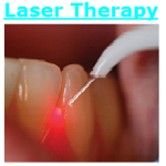 Dental Laser Fairfax VA Dentist Fair Oaks Mall